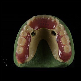 পিক ফ্রেমওয়ার্ক ডেনচার