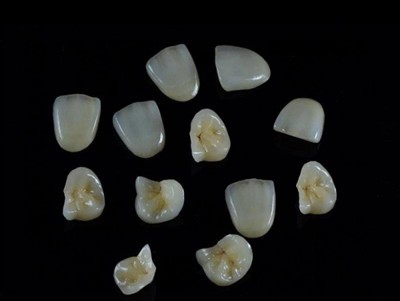 মুকুটের জন্য সেরা দাঁতের আঠালো কীভাবে চয়ন করবেন: একটি সর্বশেষ গাইড