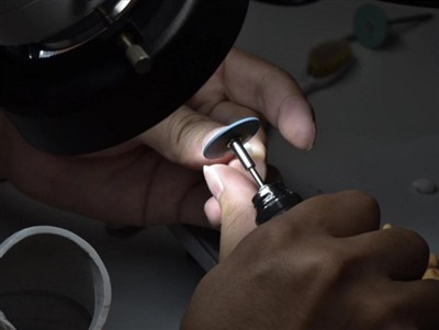 PFM মুকুট কতক্ষণ স্থায়ী হয়? গড় আয়ুষ্কাল, কারণ এবং যত্ন টিপস