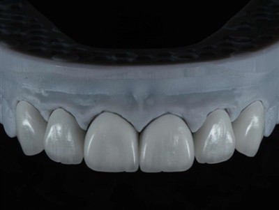 কিভাবে ডেন্টাল ল্যাব টেকনিশিয়ান কাজ বিদেশে আউটসোর্স: একটি ব্যাপক গাইড